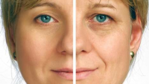 Cosmetische chirurgie en het gelaat